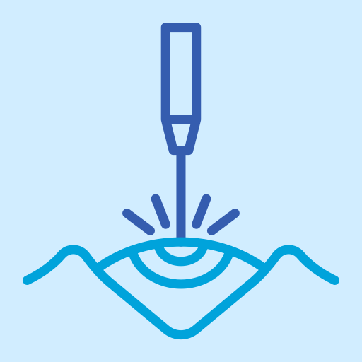 Chirurgie réfractive